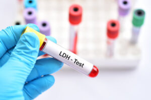 LDH Blood Test