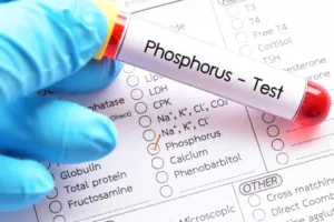 Phosphorus Test 