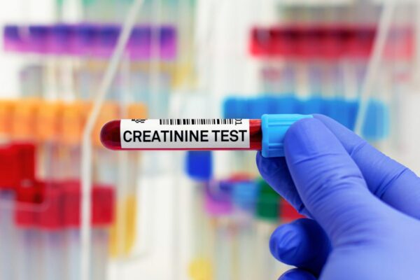 Creatinine Test 