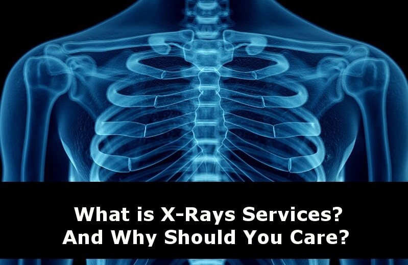 X-Rays Services in Pune