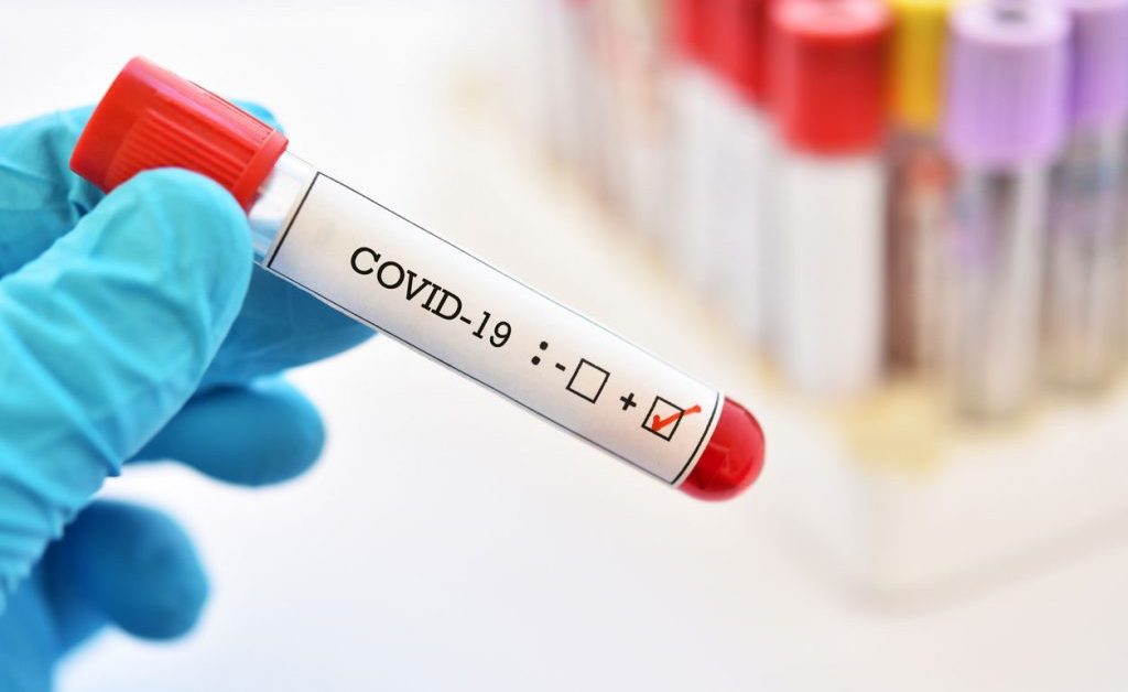 Coronavirus Test in Pune