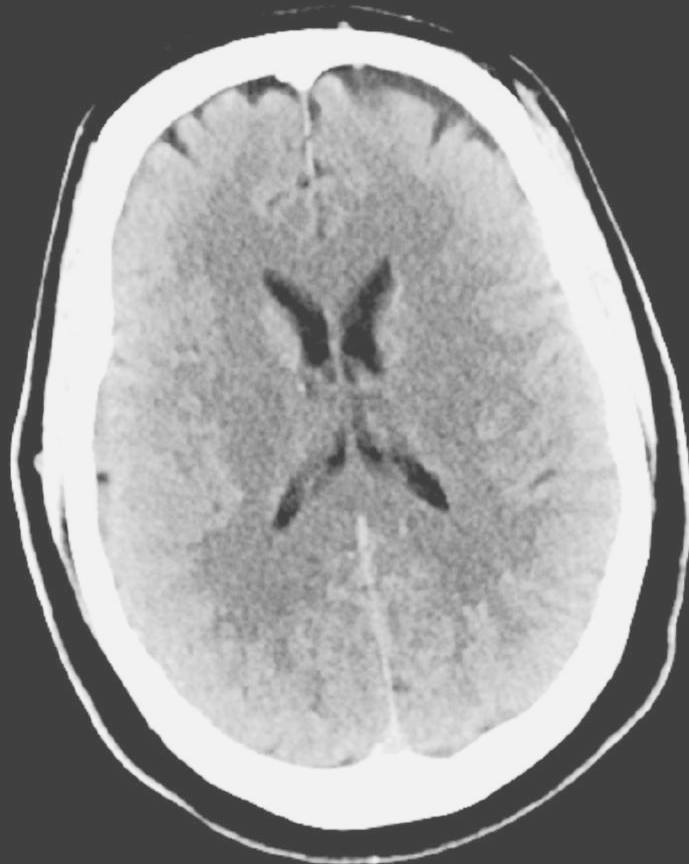 Head CT Scan Cost in Pune Brain CT Scan near me Sunrise Diagnostic