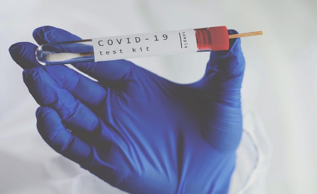 Covid Rapid Antigen Test