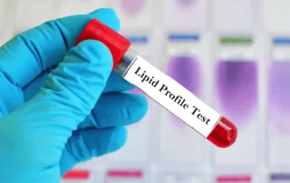 Lipid Profile Test Pune