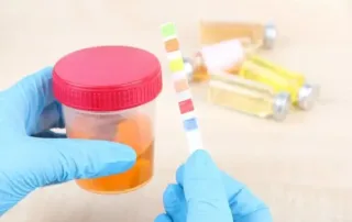 Urine Routine Test