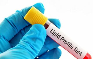 lipid profile test