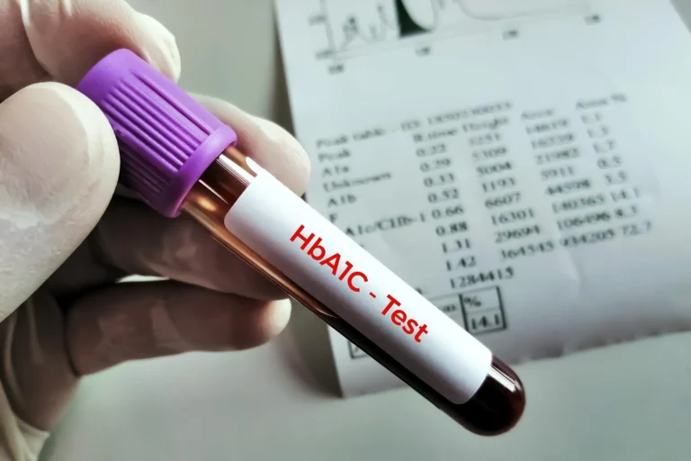 All You Need To Know About HbA1c Test in Pune