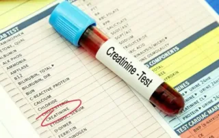 Creatinine Test in Kothrud Pune