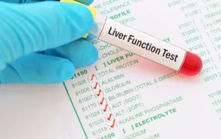 Liver Function Test