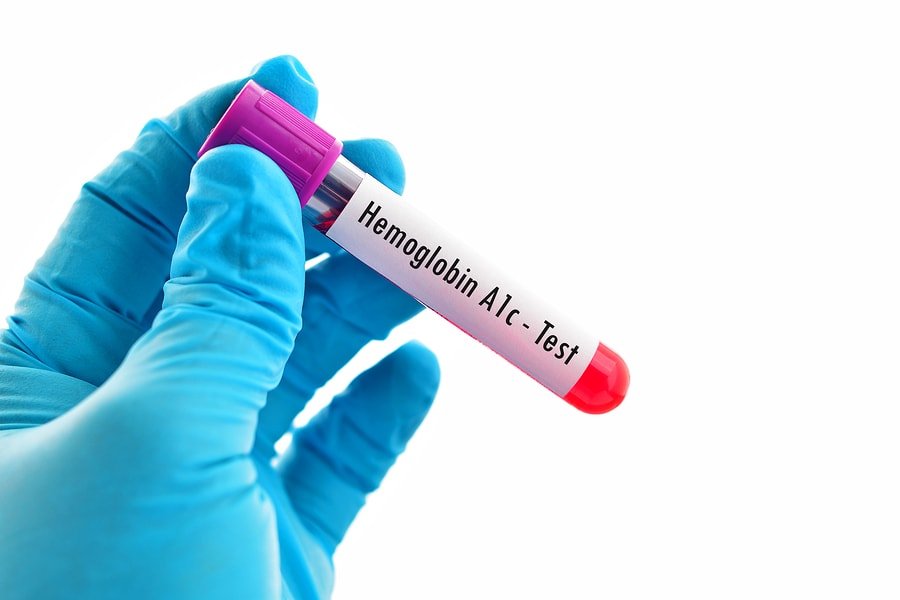 hemoglobin-a1c