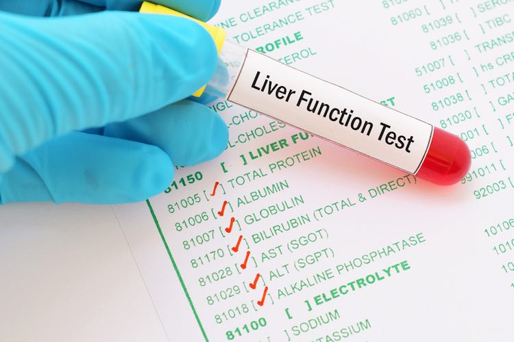 liver-function-test