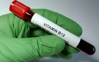 Vitamin B12 Test Kothrud Pune