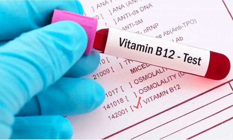 All You Need To Know About Vitamin B12 Test Kothrud Pune