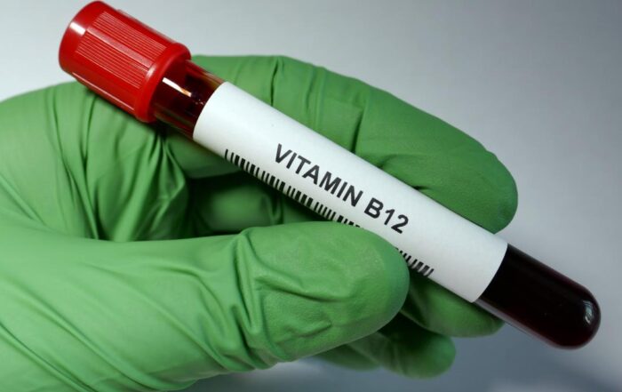 vitamin b12 test