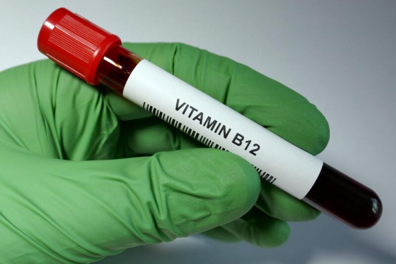 All You Need To Know About Vitamin B12 Test - Sunrise Diagnostic Centre