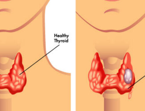 5 Common Symptoms of Thyroid Problems – How the TSH Test Can Help