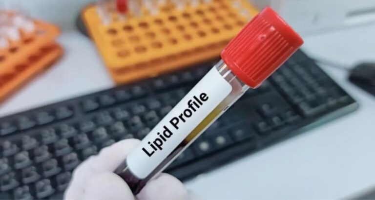 Affordable Lipid Profile Test: Find the Best Deals Near Pune