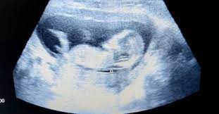 sonography services in Pune