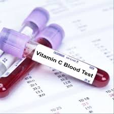 vitamin c test