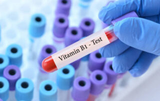 Vitamin B1 Test