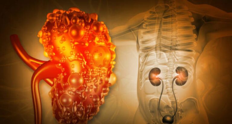 Creatinine Test in Kothrud Pune