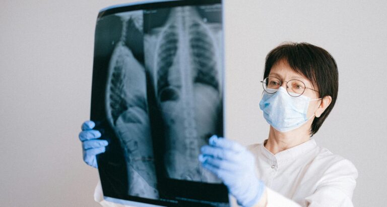 Your Trusted Destination for Advanced X-Ray Services in Baner