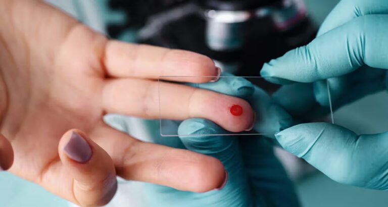 Hemoglobin Test: What It Is, Procedure & Results