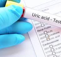 uric acid test in pune