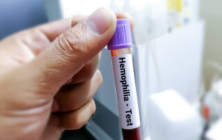 hemoglobin test