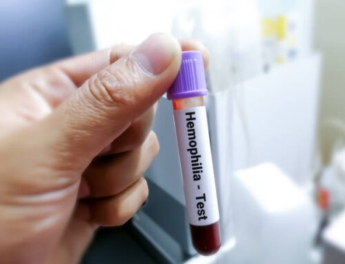 Hemoglobin Test: What It Is, Procedure & Results