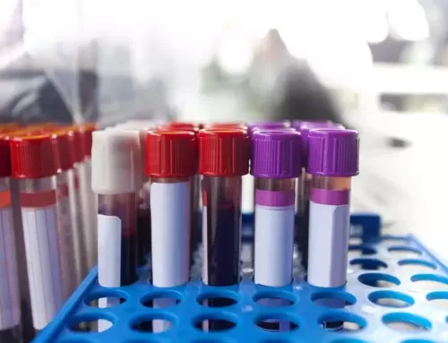 Why Regular Blood Tests Are Essential: Benefits of Pathology Services in Pune