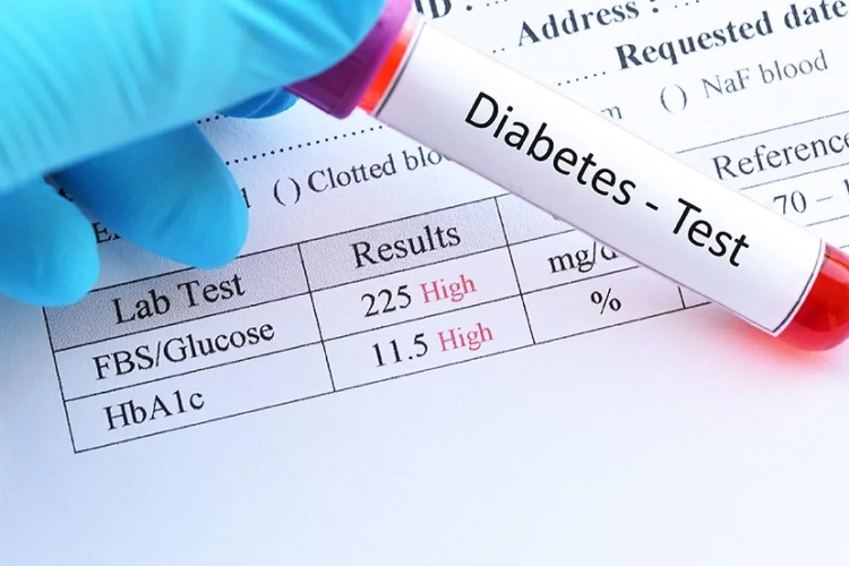 Understanding the Different Types of Blood Sugar Tests Which One ...