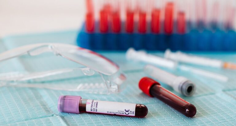 Understanding the Different Types of Blood Sugar Tests: Which One is Right for You?
