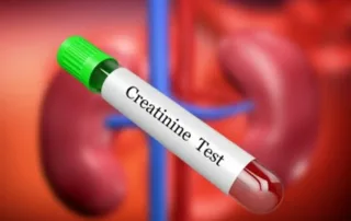 Creatinine Test