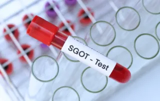 SGOT Test in Pune