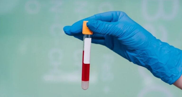 Understanding the SGOT Test in Pune: Early Insights into Liver, Heart & Muscle Health