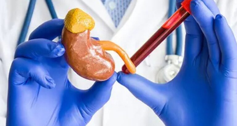Understanding the Creatinine Test: What Your Kidneys Are Trying to Tell You – Sunrise Diagnostic Centre, Pune