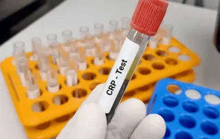 CRP Blood Test