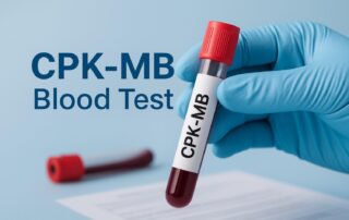 CPK-MB Test in Pune