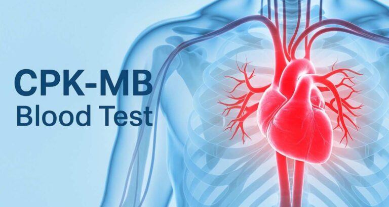 CPK-MB Blood Test in Pune – Early Detection of Heart Damage at Sunrise Diagnostic Centre