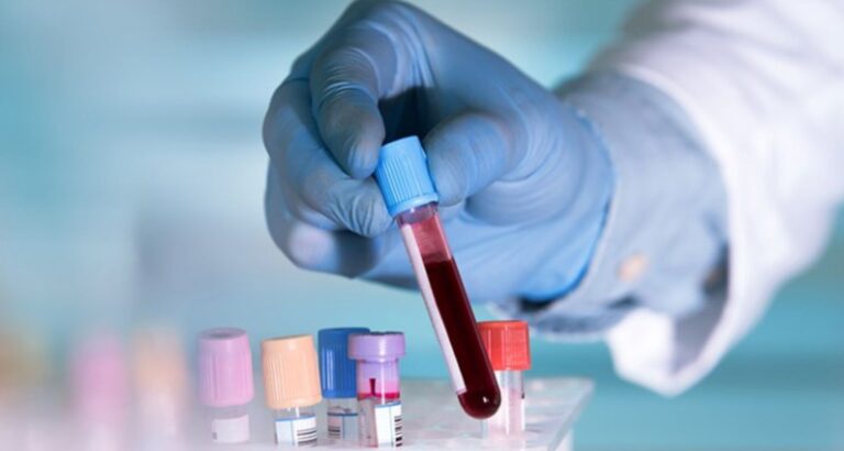 PTTK Blood Test in Pune – Check Your Blood Clotting Health at Sunrise Diagnostic Centre