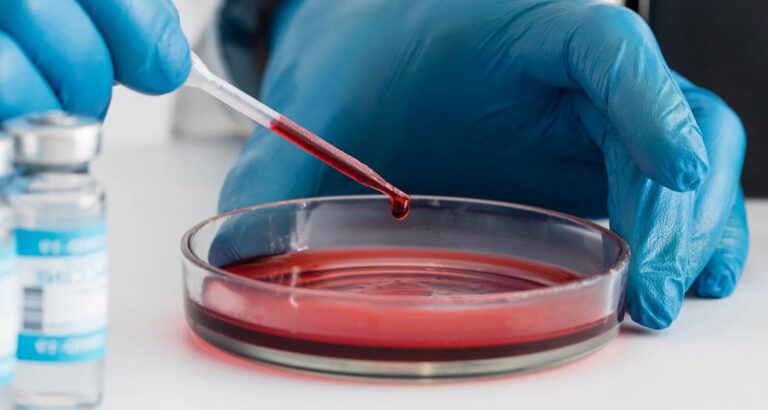 SGPT Test in Pune – Early Detection of Liver Health at Sunrise Diagnostic Centre
