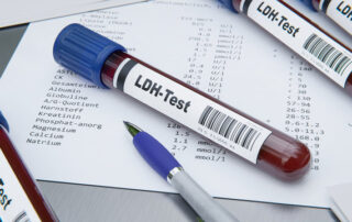 LDH Blood Test