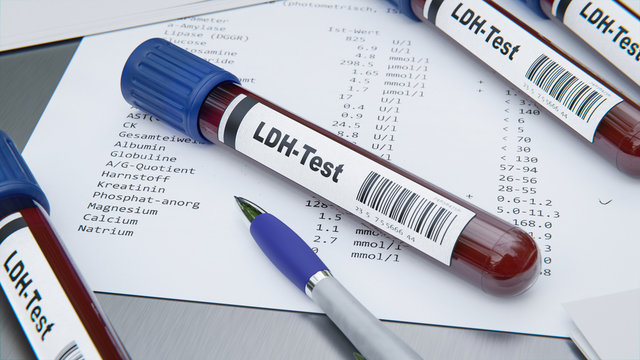 LDH Blood Test