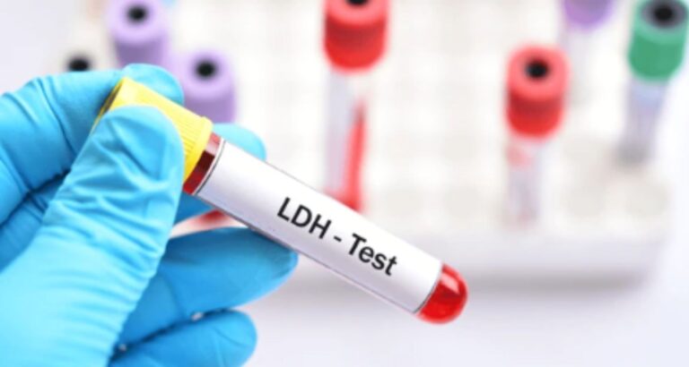 LDH Blood Test – Purpose, Procedure & Normal Range