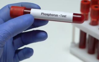 Phosphorus Test