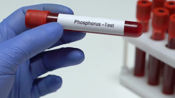 Phosphorus Test