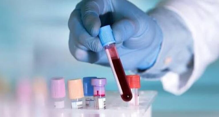 Protein Blood Test | Purpose, Normal Range & Results Explained