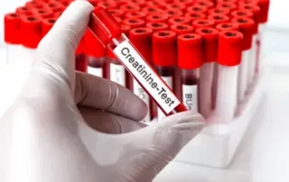 Creatinine Test