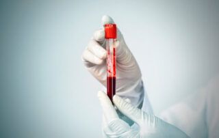 Blood Test Home Collection in Pune